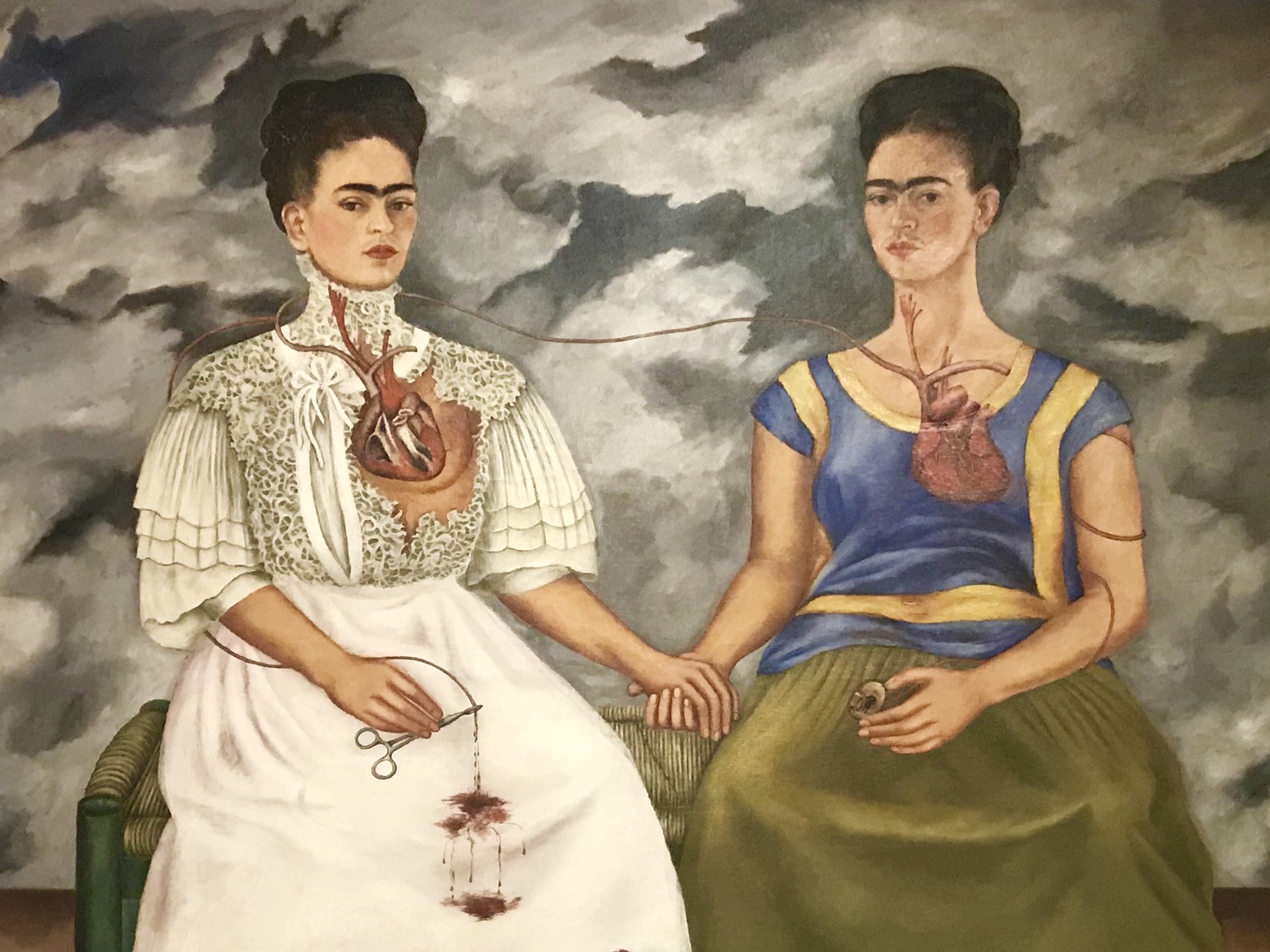 De que murió frida kahlo wikipedia